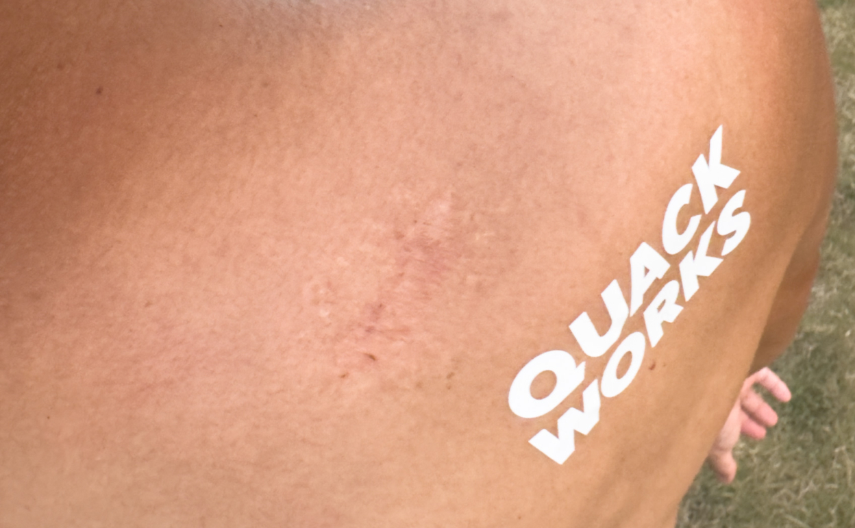 肌にカッティングシートは貼れるのか。そして日焼け跡はできるのかの実験