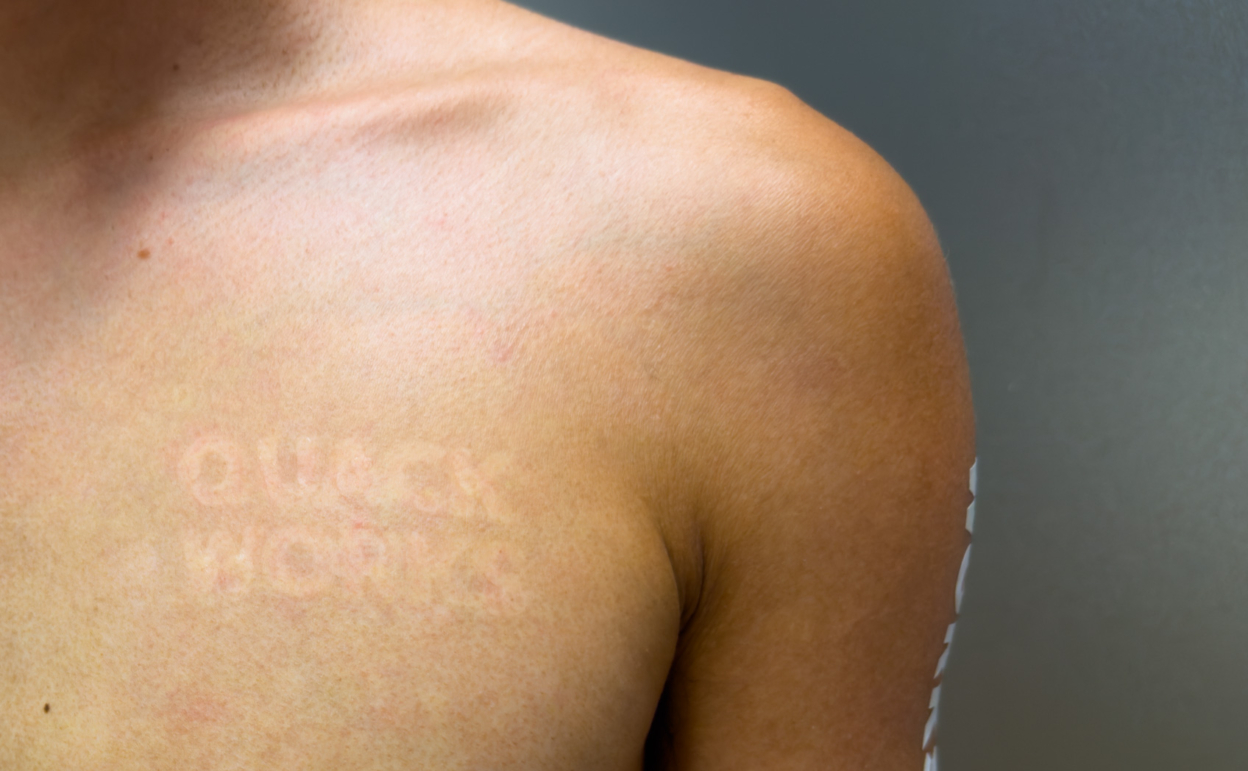 肌にカッティングシートは貼れるのか。そして日焼け跡はできるのかの実験